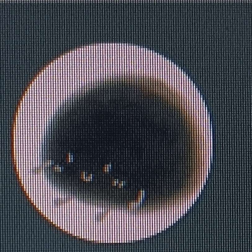 表白