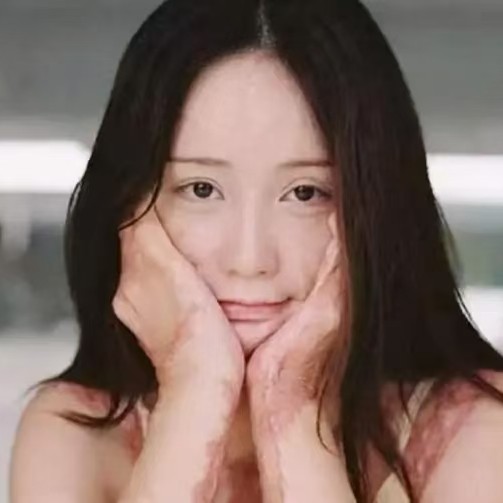 《瘢痕》